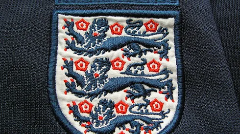 England Needs to Play Ugly to Stand Any Chance at Euro 2012