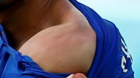 Photo reveals Luis Suarez bite marks On Italy's Giorgio Chiellini