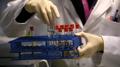 WADA alarmed by lack of La Liga drug testing