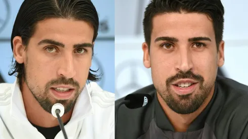 Bad hair day but Khedira set for Juventus return
