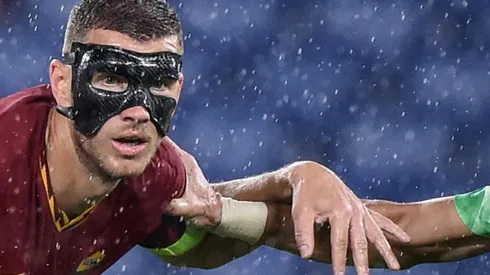 Masked man Dzeko 'can't see very well' but still scores