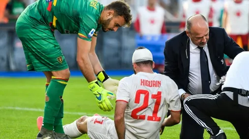 Juventus's Higuain suffers head knock in bruising Lecce stalemate