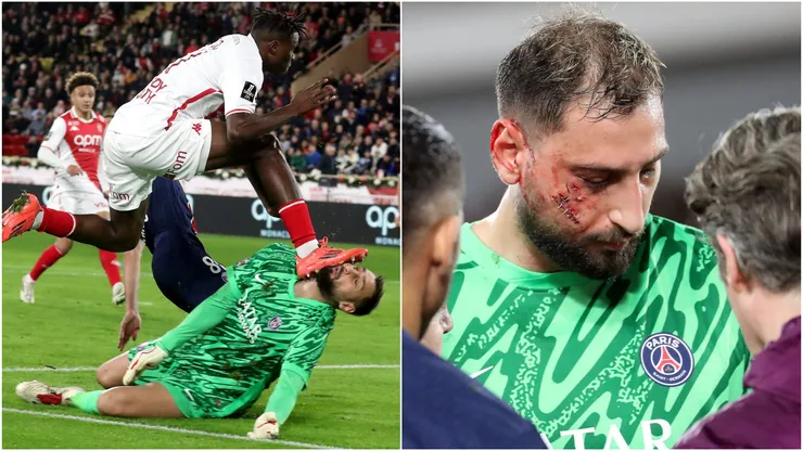 MONACO AS MONACO vs PARIS SAINT GERMAIN – 16th day of the French championship 2024 2025 Paris player Donnaruma injury after having been hit by Singo during match.