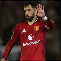 How to watch Manchester United vs Burnley in the USA: Live Stream and TV for 2025/2026 Premier League